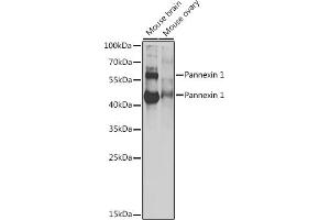 Western blot analysis of extracts of various cell lines, using Pannexin 1 antibody (ABIN6128523, ABIN6145204, ABIN6145206 and ABIN6217644) at 1:1000 dilution. (PANX1 antibody  (AA 297-426))