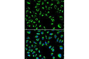 Immunofluorescence analysis of MCF-7 cells using PPP4C antibody. (PPP4C antibody)