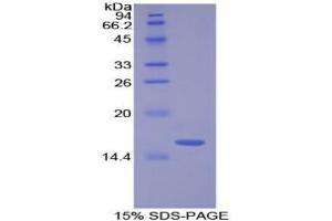 SDS-PAGE analysis of Cow Lysozyme Protein. (LYZ Protein)
