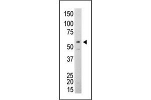 Western Blotting (WB) image for anti-Nuclear Receptor Coactivator 1 (NCOA1) antibody (ABIN356411) (NCOA1 antibody)