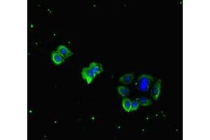 Immunofluorescent analysis of HepG2 cells using ABIN7177754 at dilution of 1:100 and Alexa Fluor 488-congugated AffiniPure Goat Anti-Rabbit IgG(H+L) (PDGFD antibody  (AA 24-370))