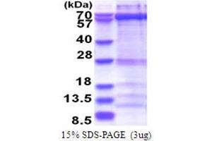 SDS-PAGE (SDS) image for Zwilch, Kinetochore Associated, Homolog (ZWILCH) (AA 1-591) protein (His tag) (ABIN5853741) (ZWILCH Protein (AA 1-591) (His tag))