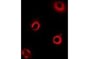 Immunofluorescent analysis of ArgRS staining in MCF7 cells. (ArgRS antibody)