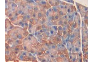 #VALUE! (MYLK4 antibody  (AA 96-353))