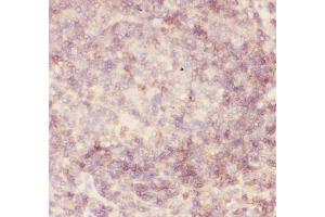 Immunohistochemistry (IHC) image for anti-Protein tyrosine Phosphatase, Receptor Type, C (PTPRC) (AA 1113-1304) antibody (ABIN3043913)