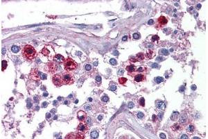 Human Testis: Formalin-Fixed, Paraffin-Embedded (FFPE) (SKA3 antibody  (C-Term))