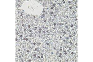 Immunohistochemistry of paraffin-embedded mouse liver using MYC antibody (ABIN4904459) at dilution of 1:100 (40x lens). (c-MYC antibody)