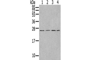 Gel: 12 % SDS-PAGE,Lysate: 40 μg,Lane 1-4: A549 cells, Jurkat cells, A375 cells, HepG2 cells,Primary antibody: ABIN7192977(UBTD1 Antibody) at dilution 1/300 dilution,Secondary antibody: Goat anti rabbit IgG at 1/8000 dilution,Exposure time: 1 minute
