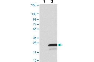 Western blot analysis of Lane 1: Negative control (vector only transfected HEK293T lysate). (TMEM138 antibody)