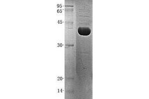 Validation with Western Blot (ADPRH Protein (His tag))