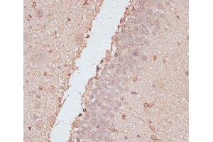 Immunohistochemistry of paraffin-embedded Rat brain using HSF1 Polyclonal Antibody at dilution of 1:100 (40x lens).