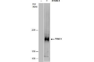 WB Image TENC1 antibody detects TENC1 protein by western blot analysis.