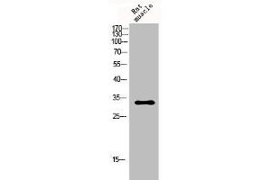 Western Blot analysis of rat-musle cells using p57 Polyclonal Antibody (CDKN1C antibody  (N-Term))