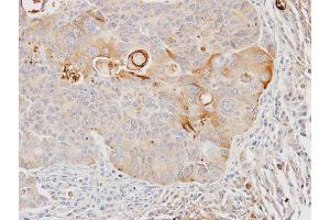 IHC-P Image Immunohistochemical analysis of paraffin-embedded SW480 xenograft, using GSTA4, antibody at 1:100 dilution. (GSTA4 antibody)