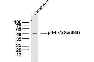 Mouse brain lysates probed with Elk1(Ser383) Polyclonal Antibody, unconjugated  at 1:300 overnight at 4°C followed by a conjugated secondary antibody at 1:10000 for 90 minutes at 37°C.