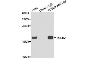 Immunoprecipitation analysis of 150ug extracts of MCF7 cells using 3ug TCEB2 antibody.