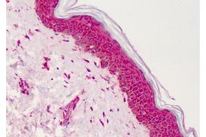 Human Skin: Formalin-Fixed, Paraffin-Embedded (FFPE) (PPARG antibody  (Internal Region))
