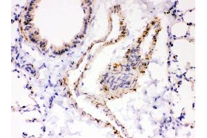Anti- ATP2A2 antibody,IHC(P) IHC(P): Mouse Lung Tissue (ATP2A2 antibody  (N-Term))