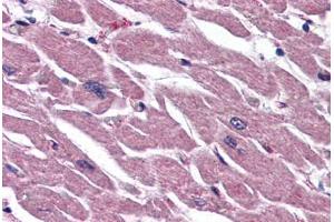 anti-Ubiquitin Interaction Motif Containing 1 (UIMC1) (N-Term) antibody