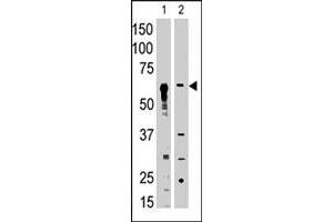 The MMP25 polyclonal antibody  is used in Western blot to detect MMP25 in mouse liver tissue lysate (lane 1) and HL-60 cell lysate (lane 2) lysate.