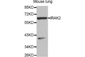 Western Blotting (WB) image for anti-Interleukin-1 Receptor-Associated Kinase 2 (IRAK2) (AA 1-270) antibody (ABIN3016607) (IRAK2 antibody  (AA 1-270))