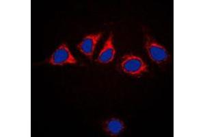 Immunofluorescent analysis of Calnexin staining in HeLa cells.