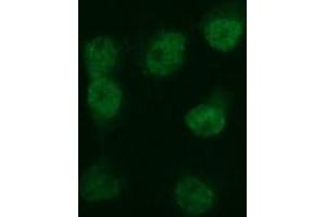 Image no. 3 for anti-Tubulin, beta 2B (TUBB2B) antibody (ABIN1501572) (TUBB2B antibody)