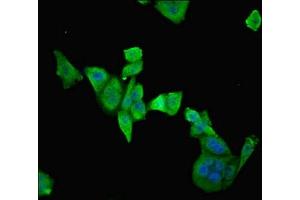 Immunofluorescent analysis of PC-3 cells using ABIN7151501 at dilution of 1:100 and Alexa Fluor 488-congugated AffiniPure Goat Anti-Rabbit IgG(H+L) (ETFDH antibody  (AA 318-617))