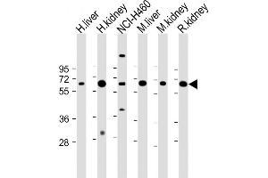 Western Blotting (WB) image for anti-phosphoenolpyruvate Carboxykinase 1 (Soluble) (PCK1) (AA 592-622), (C-Term) antibody (ABIN1882180)