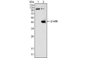 Western Blotting (WB) image for anti-Death-Domain Associated Protein (DAXX) antibody (ABIN1106953) (DAXX antibody)