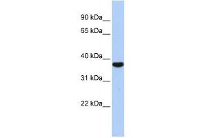 EXOSC2 antibody used at 1 ug/ml to detect target protein. (EXOSC2 antibody  (Middle Region))