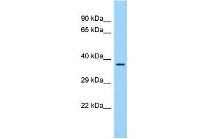 Host: Rabbit Target Name: FAM110C Sample Type: Fetal Liver lysates Antibody Dilution: 1. (FAM110C antibody  (N-Term))