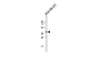 Western Blot at 1:1000 dilution + MDA-MB-231 whole cell lysate Lysates/proteins at 20 ug per lane.