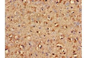 Immunohistochemistry of paraffin-embedded human brain tissue using ABIN7170725 at dilution of 1:100 (STMN2 antibody  (AA 61-129))
