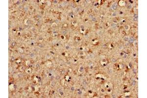 Immunohistochemistry of paraffin-embedded human brain tissue using ABIN7170725 at dilution of 1:100 (STMN2 antibody  (AA 61-129))