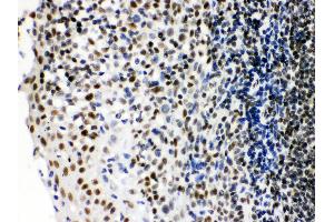 Anti- Ku70 Picoband antibody, IHC(P) IHC(P): Human Tonsil Tissue (XRCC6 antibody  (C-Term))
