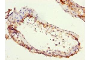 Immunohistochemistry of paraffin-embedded human testis tissue using ABIN7176044 at dilution of 1:100 (ZCCHC13 antibody  (AA 1-166))
