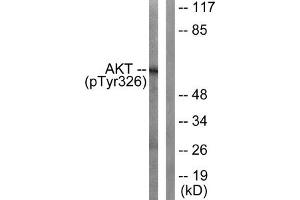 Western blot analysis of extracts from mouse liver cells, using Akt (Phospho-Tyr326) antibody. (AKT1 antibody  (pTyr326))