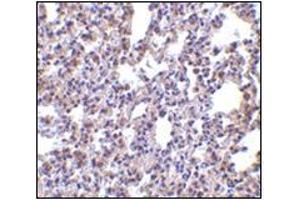 Immunohistochemistry of PKR in rat lung tissue with this product at 2. (EIF2AK2 antibody  (C-Term))