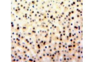 #VALUE! (GATA1 antibody  (AA 20-265))