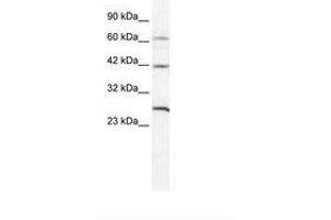 Image no. 1 for anti-Gap Junction Protein, delta 3, 31.9kDa (GJD3) (AA 31-80) antibody (ABIN202183) (Gap Junction Protein, delta 3, 31.9kDa (GJD3) (AA 31-80) antibody)