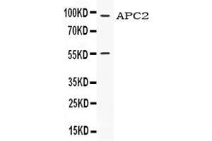Western blot analysis of APC2 expression in HELA whole cell lysates ( Lane 1). (APC2 antibody  (N-Term))