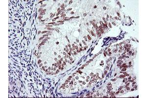 Image no. 3 for anti-Ring Finger Protein 113B (RNF113B) antibody (ABIN1500715) (RNF113B antibody)