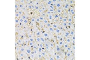 Immunohistochemistry of paraffin-embedded mouse liver using MAPT antibody (ABIN5970456) at dilution of 1/100 (40x lens). (MAPT antibody)