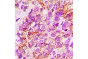 Immunohistochemistry (IHC) image for anti-N-Myc Downstream Regulated 1 (NDRG1) antibody (ABIN7308066) (NDRG1 antibody)