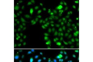Immunofluorescence analysis of MCF-7 cells using ING5 Polyclonal Antibody (ING5 antibody)