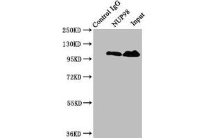 Immunoprecipitating NUP98 in Jurkat whole cell lysate Lane 1: Rabbit control IgG instead of ABIN7161832 in Jurkat whole cell lysate. (NUP98 antibody  (AA 965-1110))