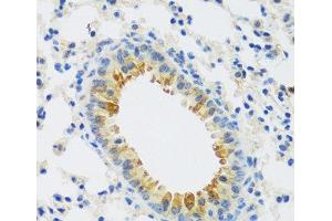 Immunohistochemistry of paraffin-embedded Mouse lung using CAMK1 Polyclonal Antibody at dilution of 1:100 (40x lens). (CAMK1 antibody)