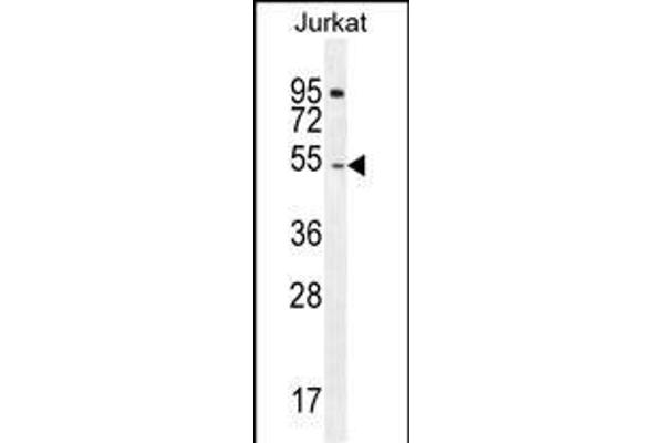 DARS antibody  (N-Term)