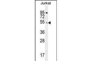 DARS Antibody (N-term) (ABIN655040 and ABIN2844671) western blot analysis in Jurkat cell line lysates (35 μg/lane). (DARS antibody  (N-Term))